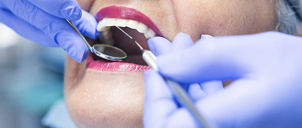 Best Emergency Root Canal Treatment in Amherst, VA